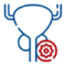 Bladder-cancer.png