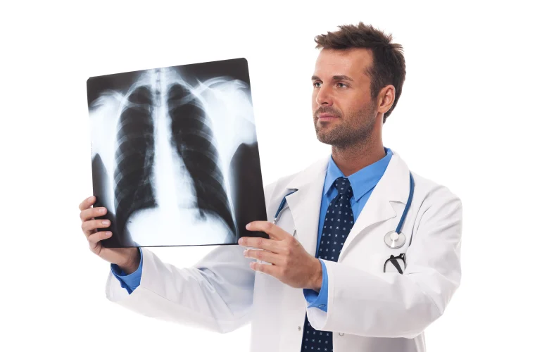 Lung Fibrosis Symptoms
