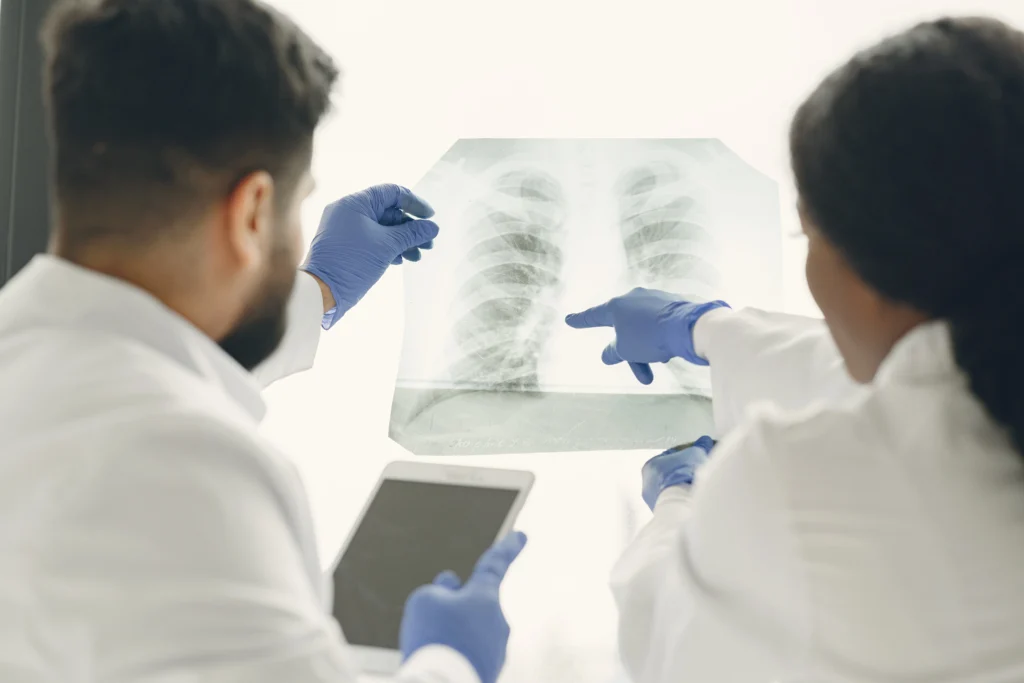 Pulmonary fibrosis is a serious and often life-altering condition that affects the lungs, causing them to become scarred and stiff over time. For many people, this progressive disease can lead to