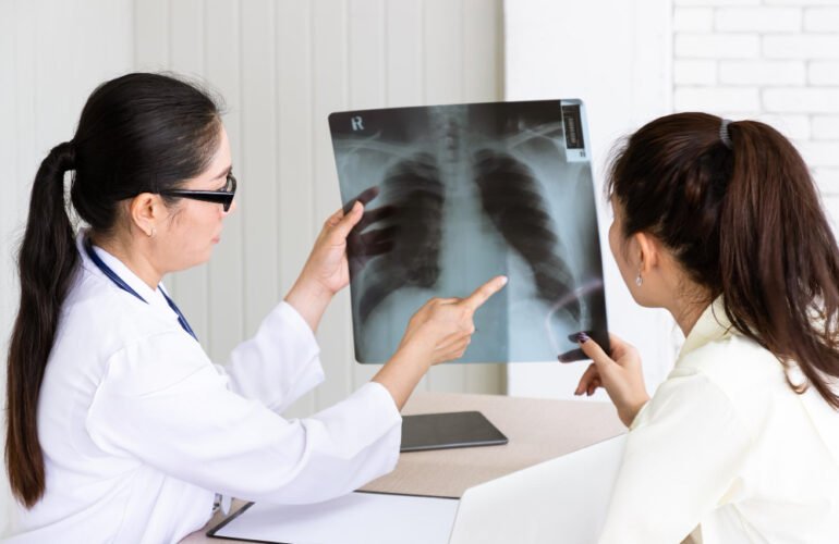 symptoms of pulmonary fibrosis