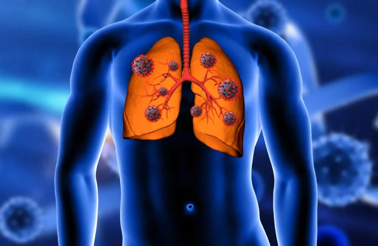 What Are the Early Signs of Fibrosis