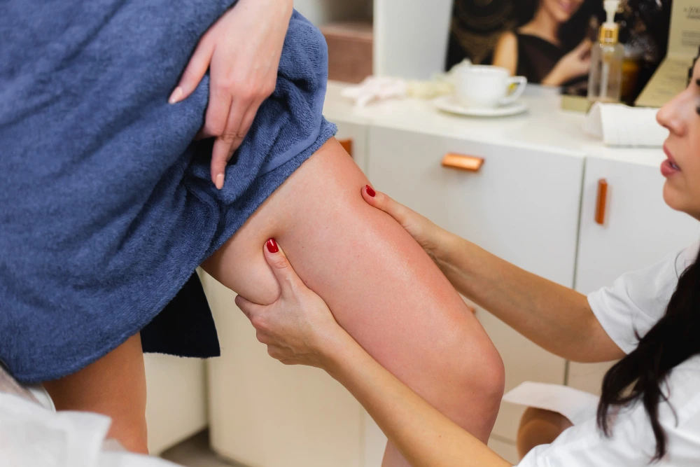 What Causes Varicose Veins