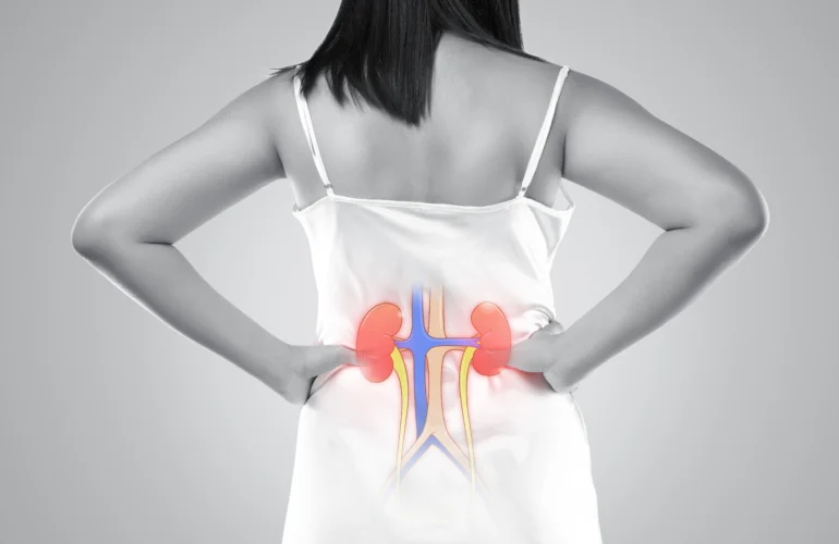 Kidney Disease Symptoms in Females