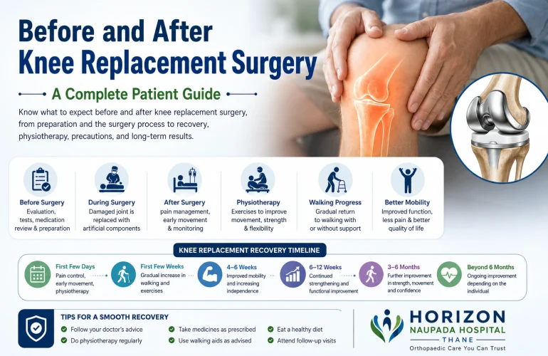 Before and After Knee Replacement Surgery