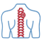 Cervical Discectomy & Fusion Surgery