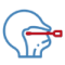 Functional Endoscopic Sinus Surgery (FESS)
