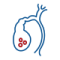Gallbladder Stones