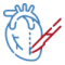 Minimally Invasive Cardiac Surgery