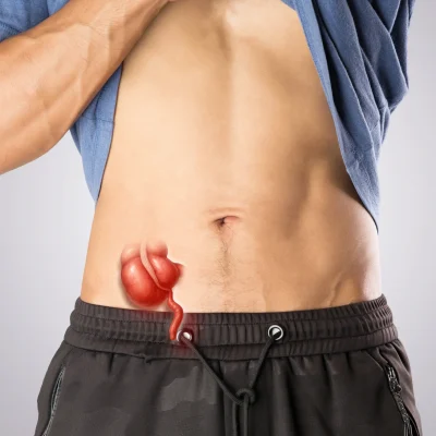 Laparoscopic Appendectomy in Thane