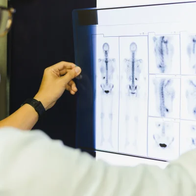 X-Ray in Thane
